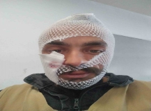 İneğinin boynuz darbeleri ile yaralanan gencin paylaşımı gülümsetti
