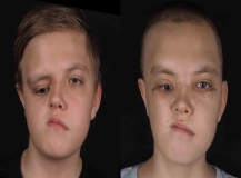 Kazakistanlı 14 yaşındaki Nikita şifayı Pendik’te buldu
